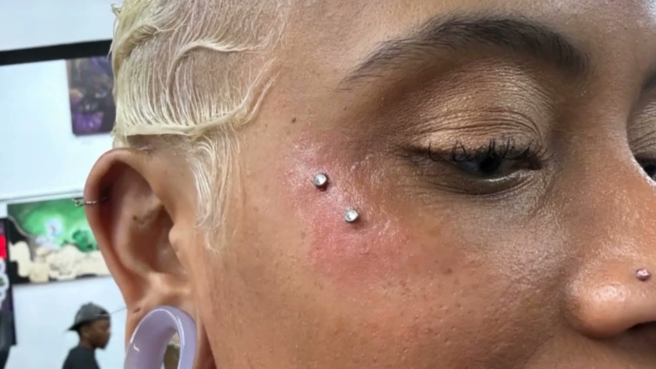 Two dermal piercings on the upper cheek, beside the eye, with a nostril stud and a stretched earlobe
